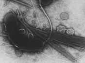 Vibrio cholerae, the bacterium that causes cholera.