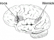 Location of two brain areas that play a critical role in language, Broca's area and Wernicke's area