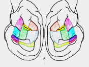English: Mirrored lateral view of a cat brain with the 13 acoustically responsive sections of the auditory cortex shown by dotted lines, and 10 sections colored to depict those implanted with cryoloops. Modified from Figure 1 of Malhotra, S., & Lomber, S.
