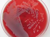 Staphylococcus aureus on Columbia Horse Blood Agar (2)