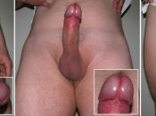 English: Erect penis (intact) of a sexually aroused postpubertal male is shown from different directions. A closer view of the glans penis is shown in the small images. The genitalia of this 33-year-old male are normal and of rather typical size and appea