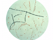 Photomicrograph of Bacillus anthracis from an agar culture demonstrating spores; Fuchsin-methylene blue spore stain.