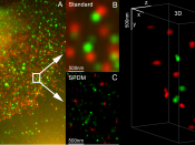 3D Dual Colour Super Resolution Microscopy with Her2 and Her3 in breast cells, standard dyes: Alexa 488, Alexa 568 LIMON
