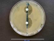 English: Culture of ESBL-producing Escherichia coli