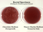 Comparison of two culture media types used to grow Neisseria gonorrhoeae bacteria. Known as overgrowth, note that the non-selective chocolate agar medium on the left, due to its composition, allowed for the growth of organismal colonies other than those o