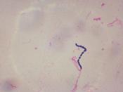 English: Close up of Streptococcus.