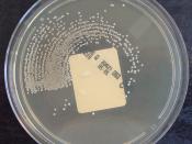 Staphylococcus aureus on ChromID CPS Agar