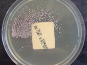 Staphylococcus saprophyticus on ChromID CPS Agar