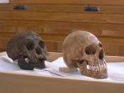 English: cast of Homo floresiensis compared to a microcephalic skull