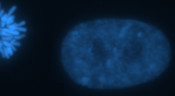 Interphase nucleus of an HT1080 cell with part of a telophase in the top left.