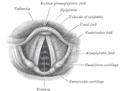 A labeled anatomical diagram of the vocal folds or cords.