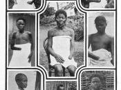 English: Mutilated people from Congo Free State