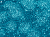 English: Embryonic Stem Cells. Image shows hESCs.