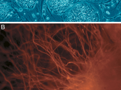 English: Embryonic Stem Cells. (A) shows hESCs. (B) shows neurons derived from hESCs.