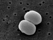 English: Scanning Electron Micrograph of Staphylococcus epidermidis