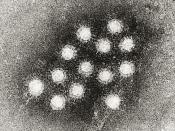 English: Cropped image of an electron micrograph of the Hepatitis A virus (HAV).