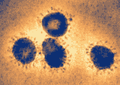 A coronavirus that may cause SARS. (transwikied from en.wikipedia.org)