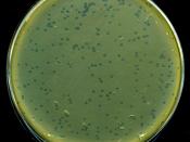 Lysis plaques of lambda phage on E. coli bacteria.