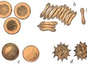 Human red blood cells. a. Seen from the surface. b. Seen in profile and forming rouleaux. c. Rendered spherical by water (hypotonic to serum). d. Rendered crenate by salt solution (hypertonic).