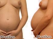 Pregnancy 34 weeks1
