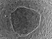 English: This image is of cell line SA02 (http://stemcells.nih.gov/research/registry/cellartis.asp). Image is of human embryonic stem (hES) cell colony on a mouse embryonic fibroblast (MEF) feeder layer.
