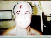 John Gotti after being physically assaulted in prison.