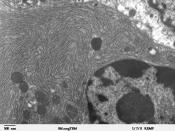 Transmission electron microscope image of a thin section cut through an area of mammalian lung tissue. This image of a Clara cell shows a nucleus and cytoplasmic organelles, such as rough endoplasmic reticulum and mitochondria. JEOL 100CX TEM