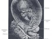 Human fetus at eight weeks. According to Catholics, the debates on abortion make the human embryo and fetus signs of contradiction