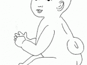 English: Schematic drawing of a baby with spina bifida.