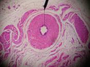 Author' own picture. Human vas deferens. Digital camera shot through a microscope.