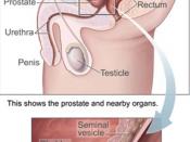 English: Prostate and bladder, sagittal section. 中文: 前列腺與膀胱，矢狀切面。