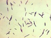 English: This photomicrograph reveals Clostridium perfringens grown in Schaedler’s broth using Gram-stain. Clostridium perfringens is a spore-forming, heat-resistant bacterium that can cause foodborne disease. The spores persist in the environment, and of