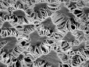 Gore-Tex membrane under an electron microscope. Size of islands about 10µm from :fr:Image:Goretex photo.gif