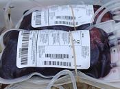English: Bags of blood collected during donation, showing dark colour of venous blood. Cropped from original photo.