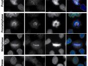 Fluorescence microscopy pictures, showing the localization of endogenous human Mad1 (one of the components of the mitotic checkpoint, in green) through the different stages along mitosis. Cenp-B (in red) is a marker for the centromere, and DAPI (in blue) 