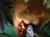 A dental hygienist demonstrates scaling.