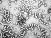 English: This electron micrograph reveals the presence of hepatitis-B virus HBV 